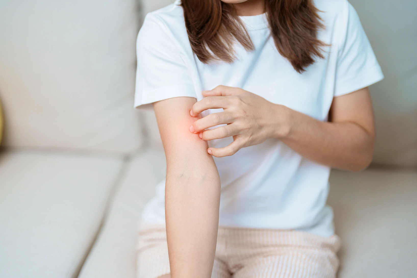 Woman scratching inner arm.