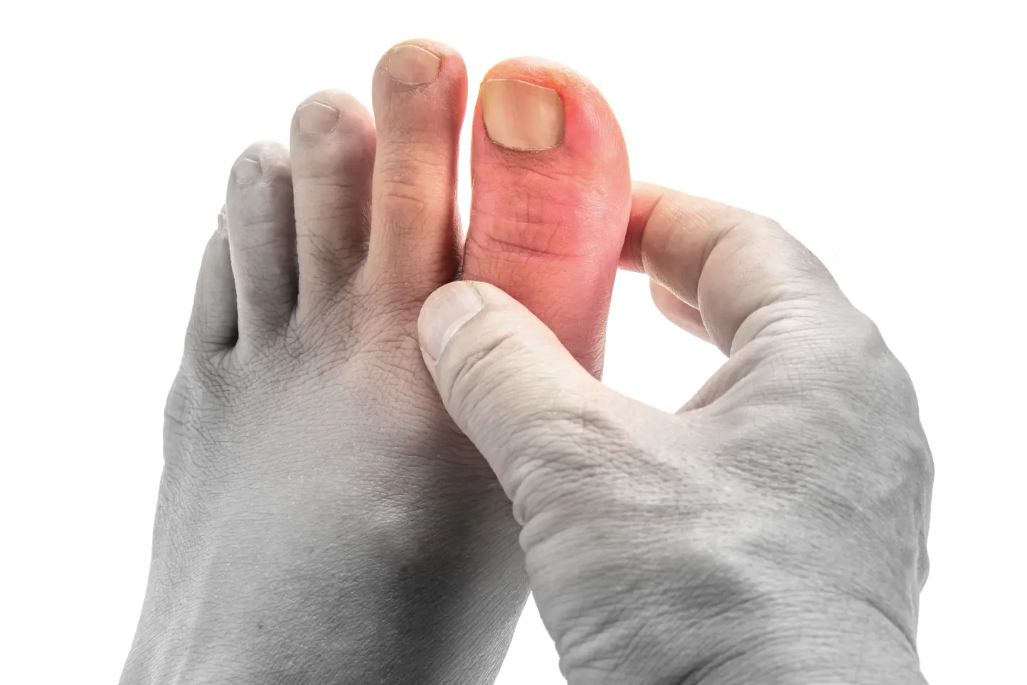 Big toe highlighted in red