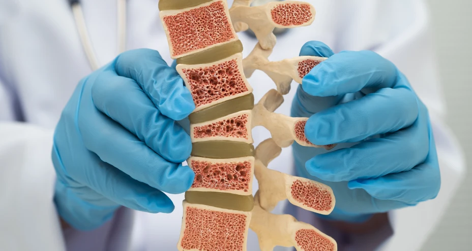Osteoporosis